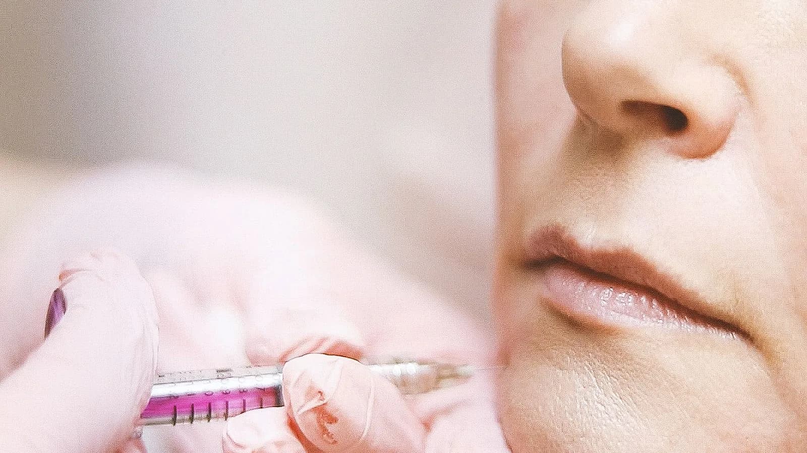 An aesthetics practitioner carefully administering dermal filler to a client's cheeks and jawline at Sultan Hair & Beauty, Cardiff