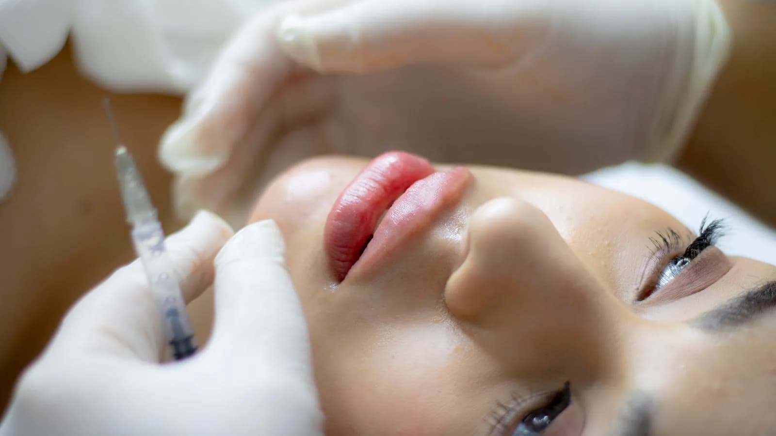 Close-up of a lip filler treatment being carefully administered at an aesthetics clinic in Cardiff