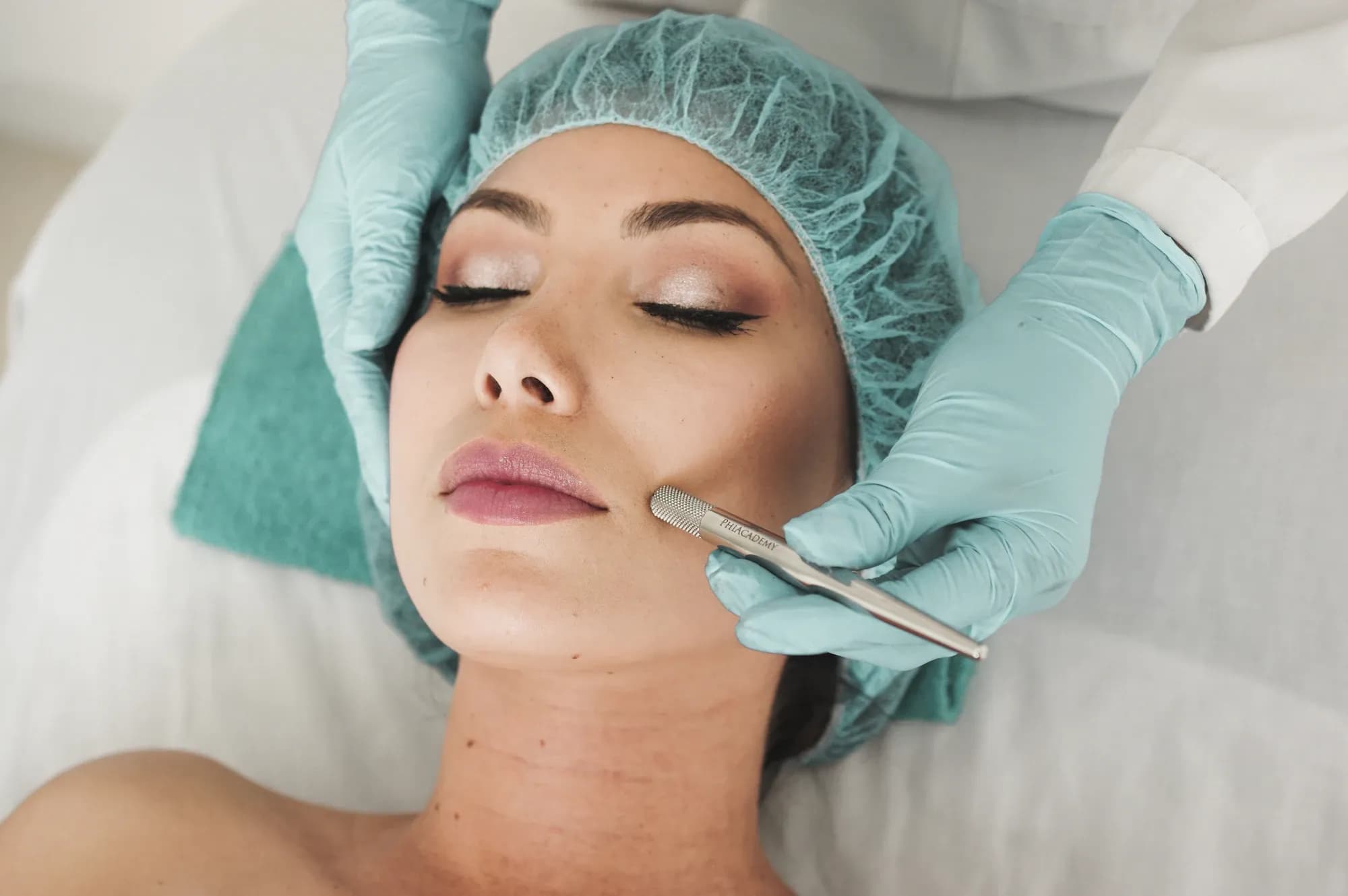 Aesthetics skin rejuvenation treatment, like Profhilo, at Sultan Hair & Beauty salon in Cardiff