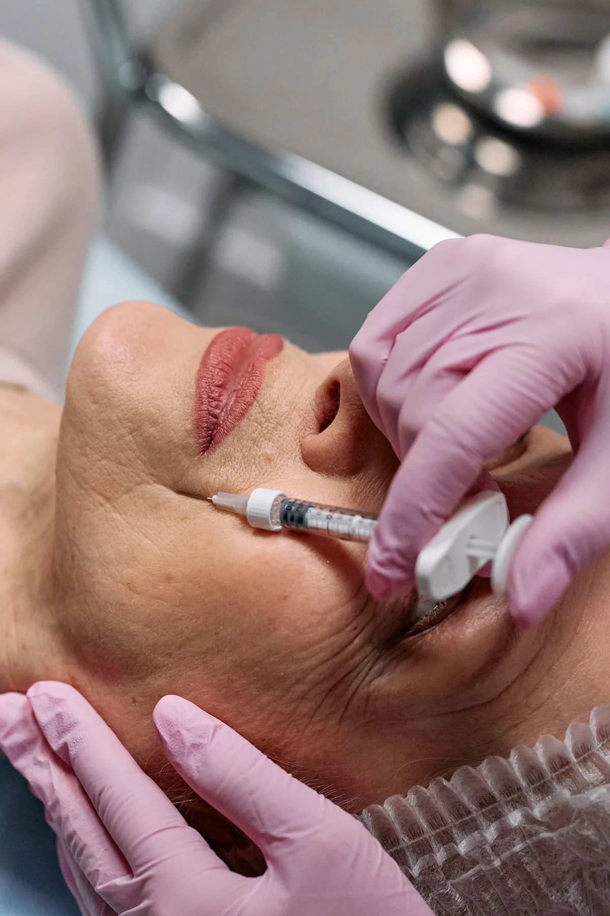 Lifted, defined cheekbones and a sharp jawline seen in a client after dermal filler treatment at Sultan Hair & Beauty, Cardiff